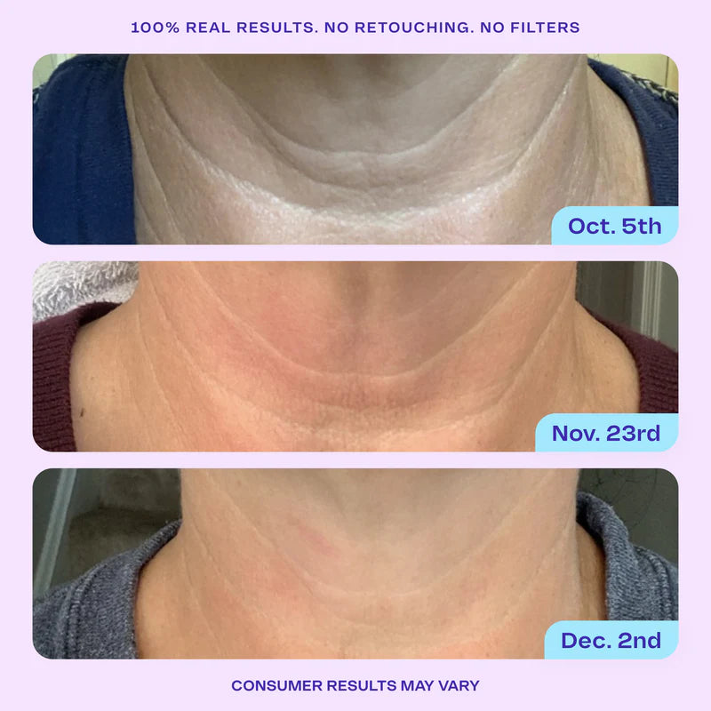 LUMI™-Neck Firming Cream