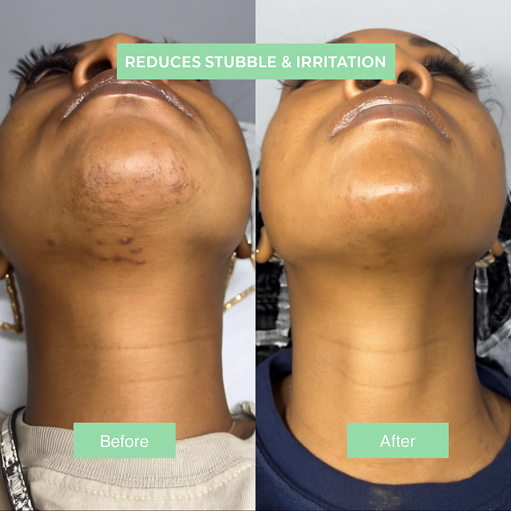 Lumi™-Cyperus Rotundus Skin Serum