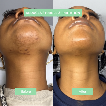 Lumi™-Cyperus Rotundus Skin Serum