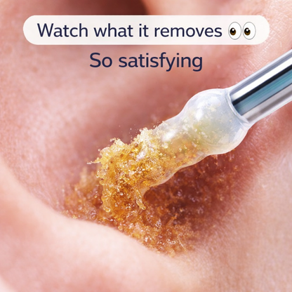 WaxLift Adhesive Ear Cleaner