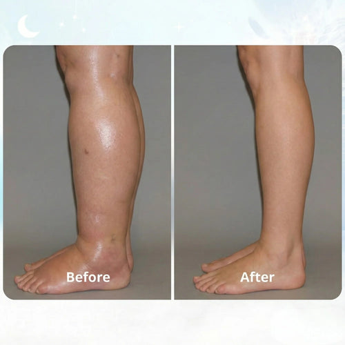 ORNEXIS - EMS FIX SWOLLEN LEGS FROM HOME