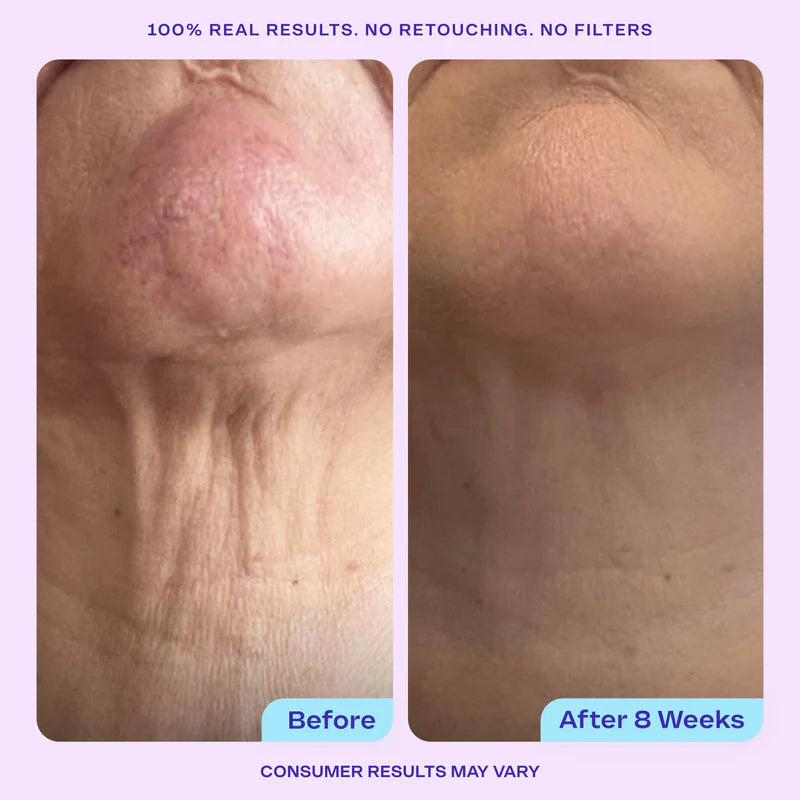 LUMI™-Neck Firming Cream