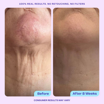 LUMI™-Neck Firming Cream